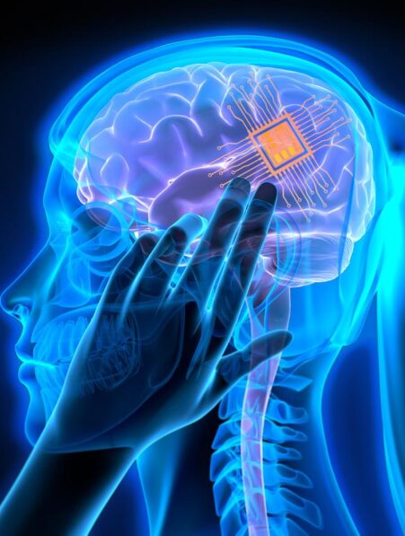 precision-neuroscience-implants-cerebraux-poses-premiere-fois-couv