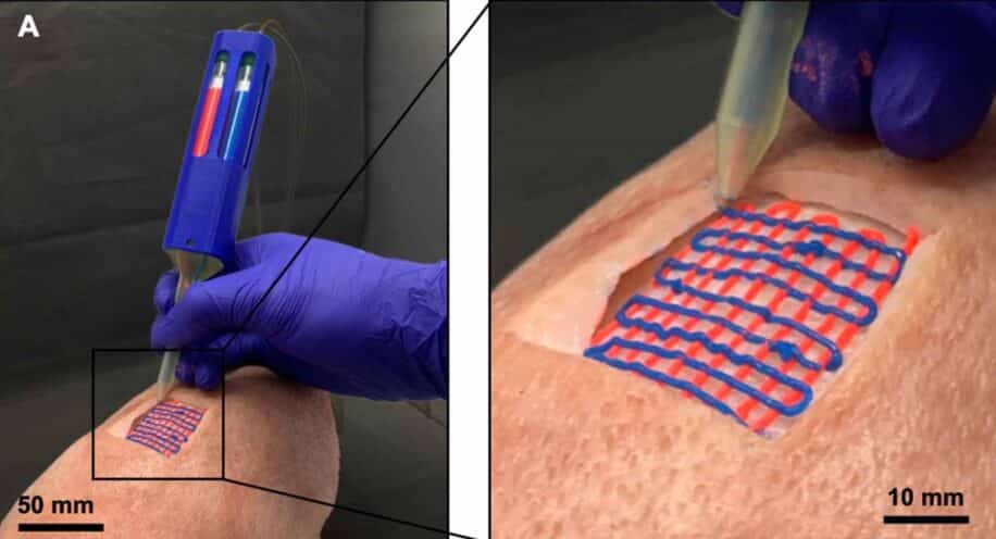 bioimprimante portable in situ