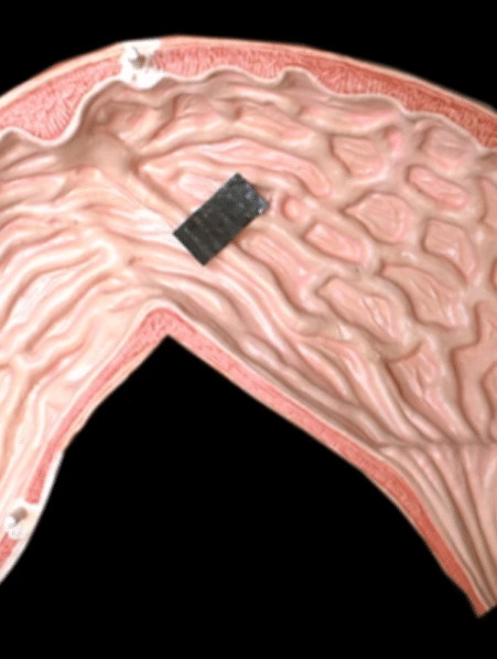 mini robot pangolin effectue soins medicaux internes couv