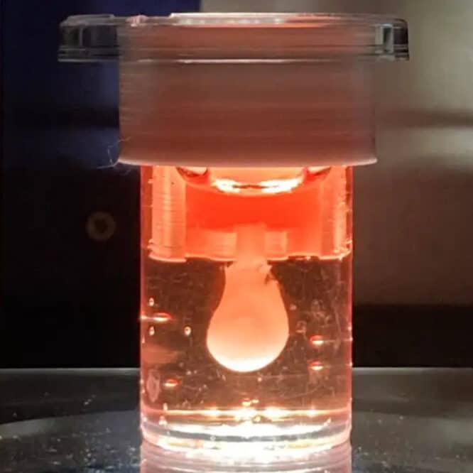ventricule cardiaque battre 3 mois