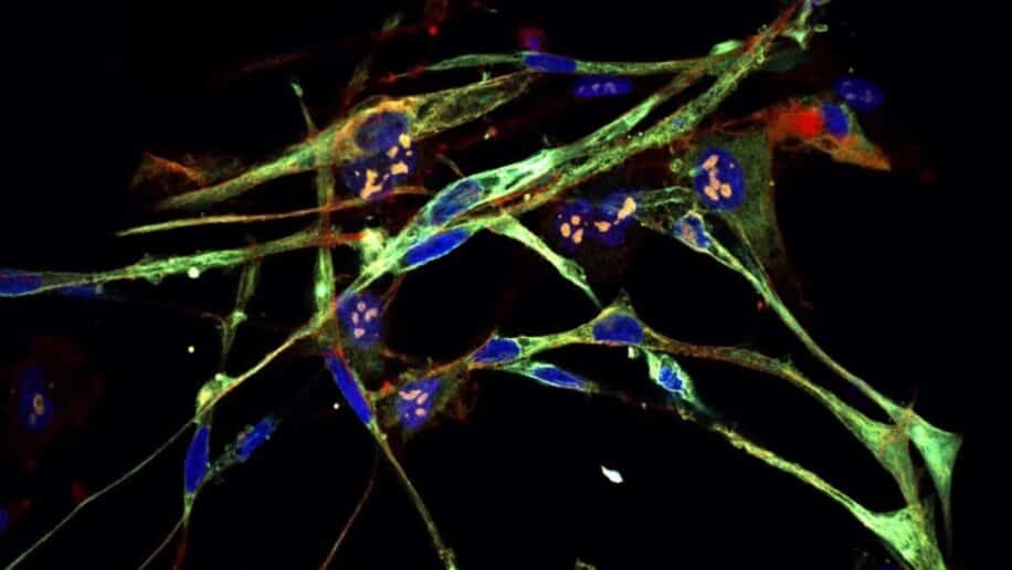 cellules musculaires cancer transformer cellules saines couv