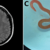 parasite ver python cerveau humain couv