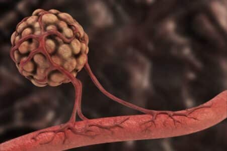 role antioxydants developpement vaisseaux sanguins cancer