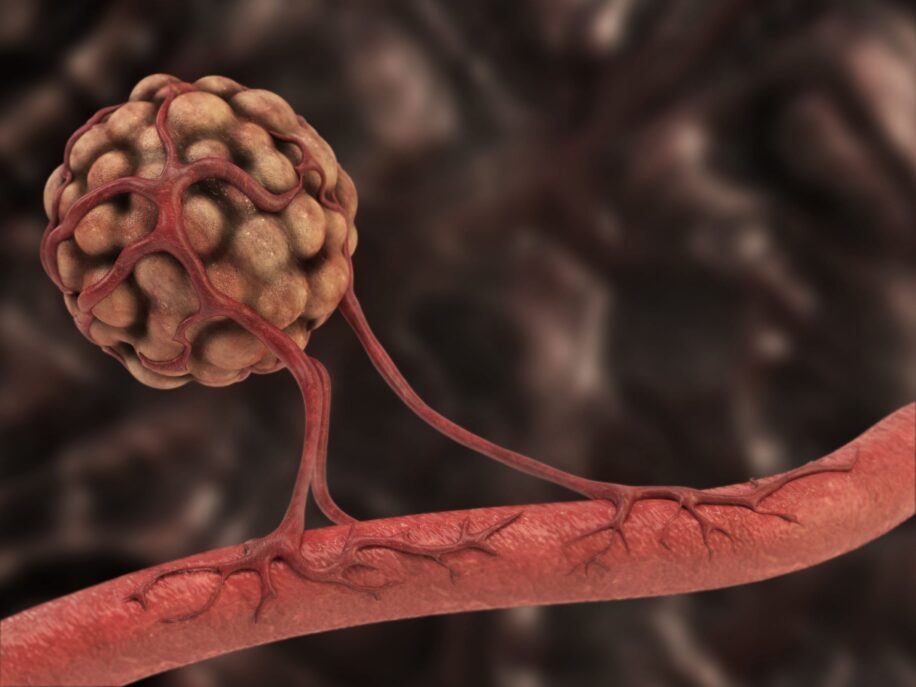 role antioxydants developpement vaisseaux sanguins cancer