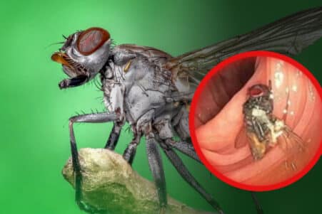 mouche intestin coloscopie couv 2