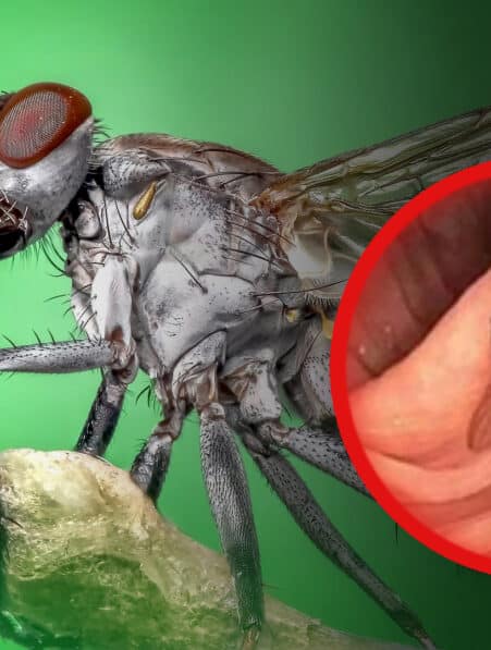 mouche intestin coloscopie couv 2