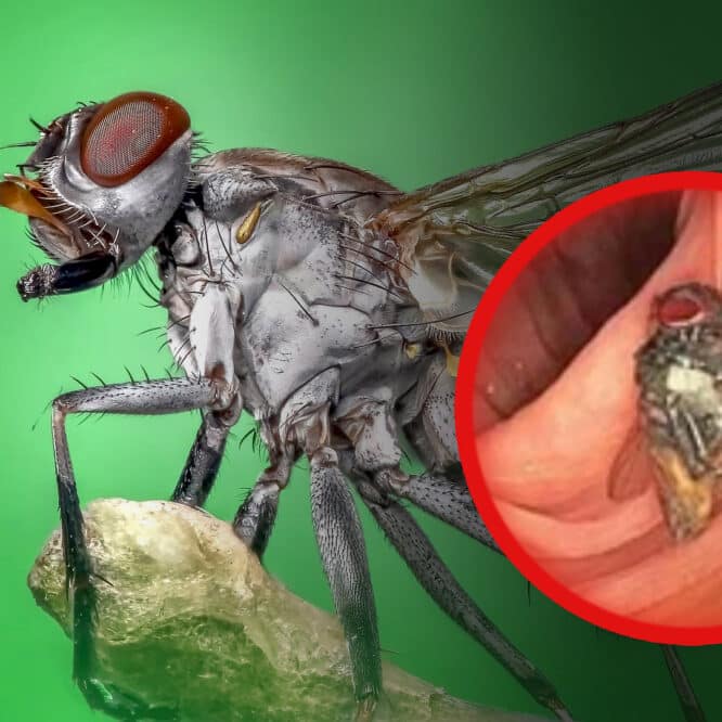 mouche intestin coloscopie couv 2