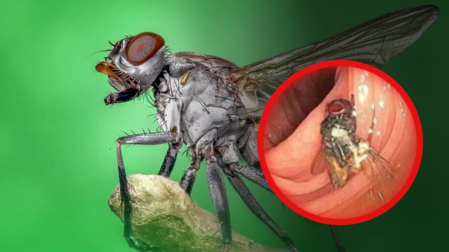 mouche intestin coloscopie couv 2