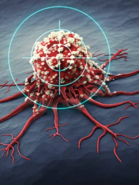compose proteine cancers