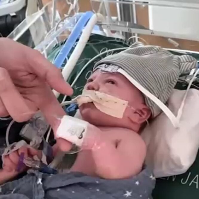 greffe cardiaque partielle bebe succes un an apres couv