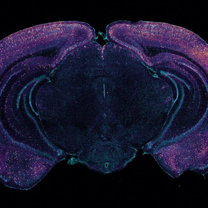 alzheimer sensorielle detoxifiant