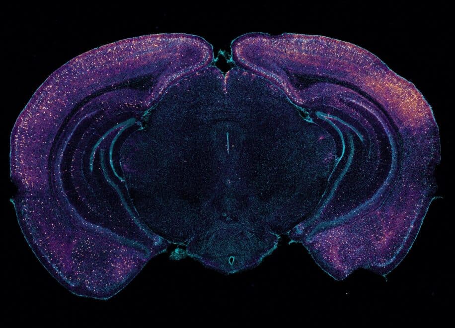 alzheimer sensorielle detoxifiant