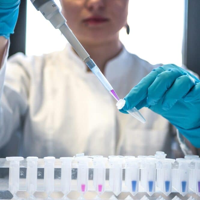 covid 19 laboratoire