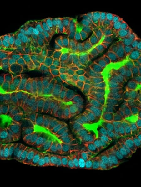 organoïdes cellules liquide amniotique couv