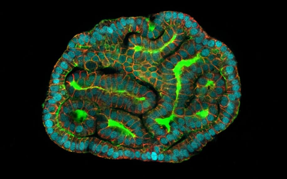 organoïdes cellules liquide amniotique couv