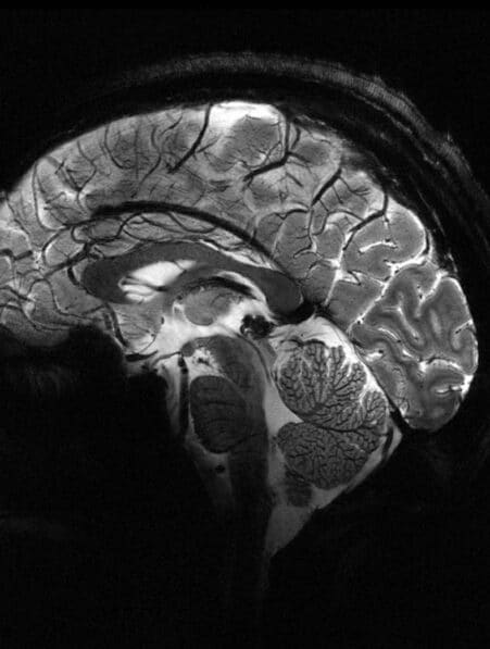 Le plus puissant appareil d'IRM au monde a dévoilé ses premières images couv