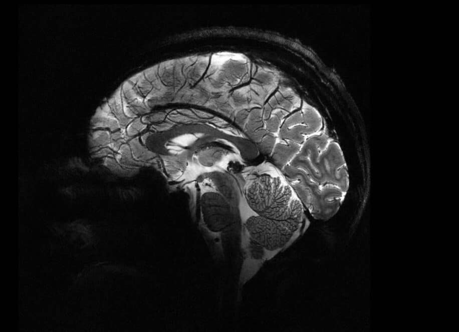 Le plus puissant appareil d'IRM au monde a dévoilé ses premières images couv