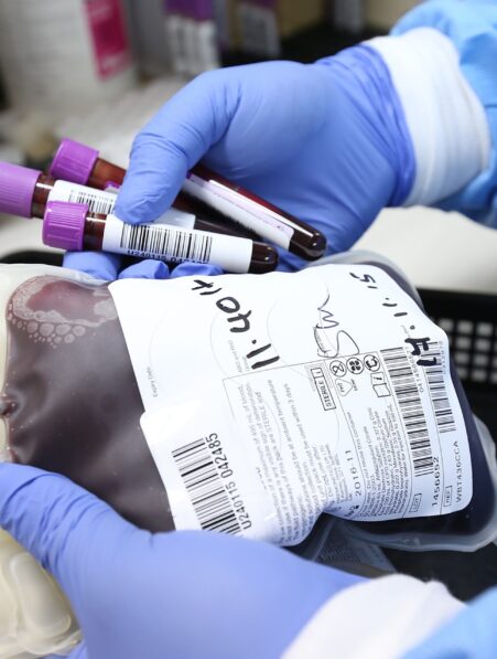 alzheimer greffe transfusion