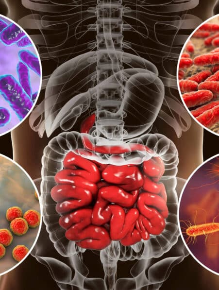 autisme microbien intestinaux