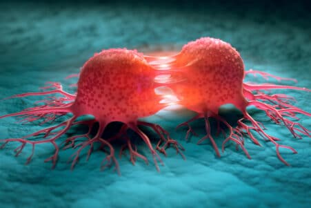 gene agressivite cancer pancreas