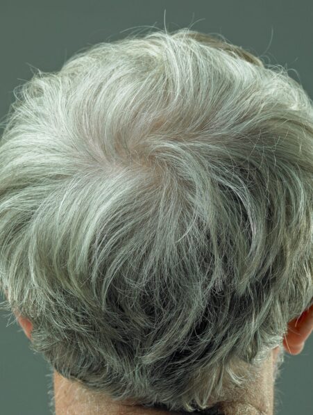Les cheveux gris sont réversibles suggère une étude