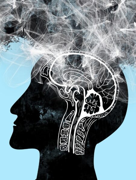 Alzheimer sans symptôme de démence le cas fascinant d’une femme trisomique intrigue les scientifiques